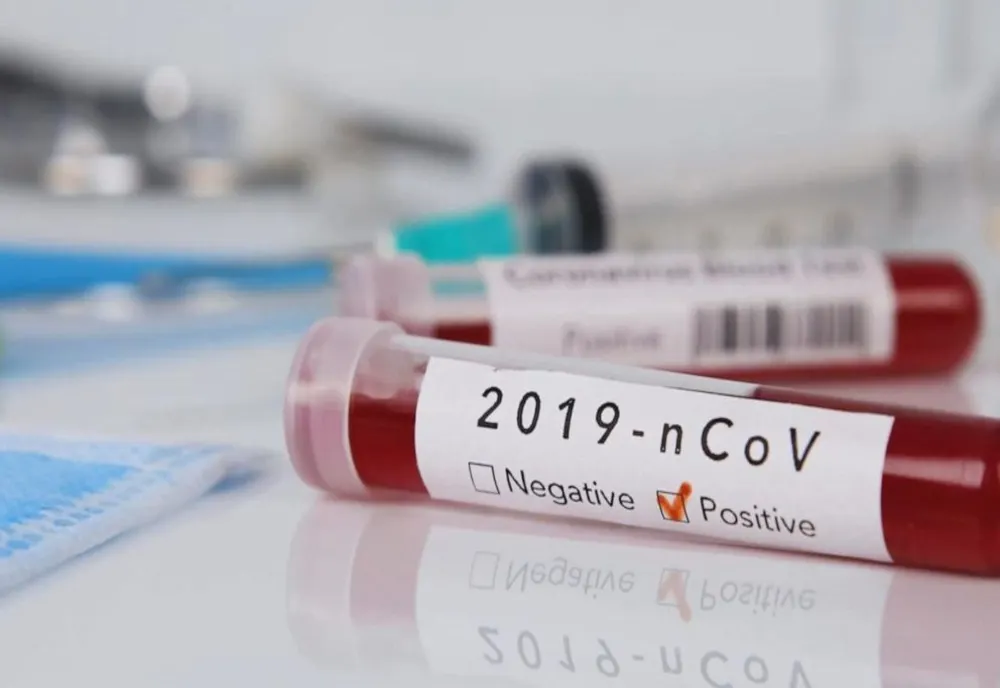 Două cazuri noi de coronavirus înregistrate în județul Hunedoara