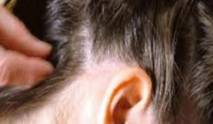 Elevii petroșăneni vor trece printr-un triaj epidemiologic