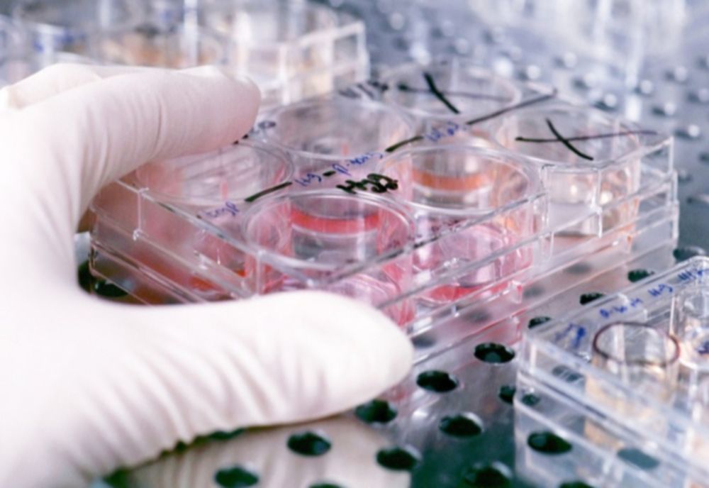 Un bărbat din județul Hunedoara a murit din cauza gripei porcine