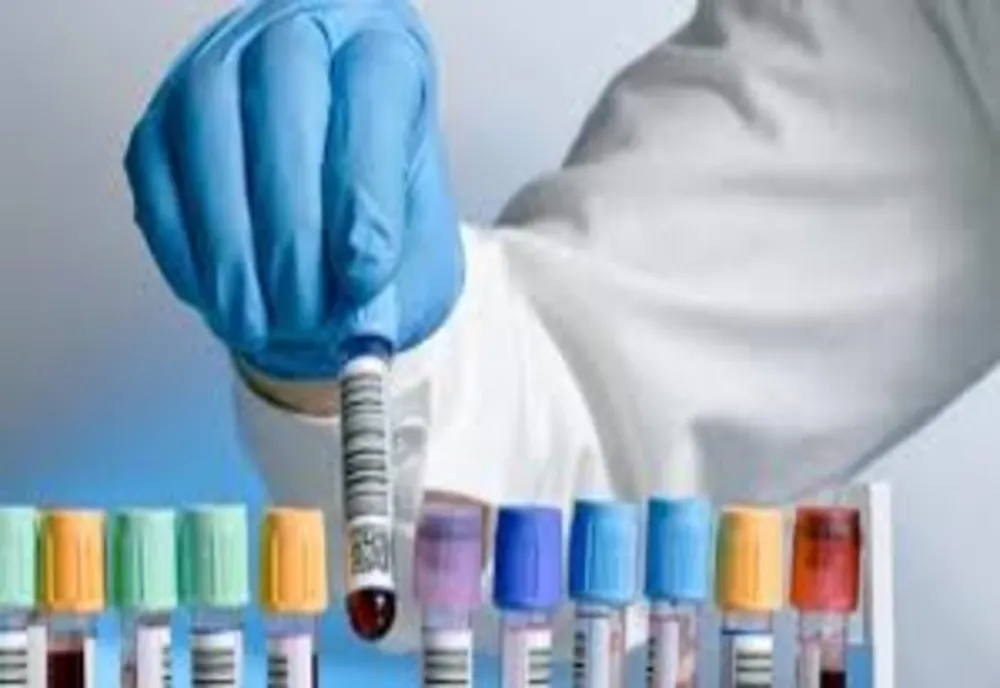 Noi cazuri de coronavirus confirmate în Hunedoara