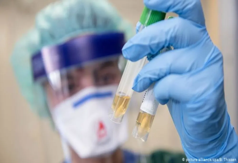 Autoritățile au raportat încă patru decese cauzate de infecția cu coronavirus. Astfel, la nivel național, bilanțul a crescut la 34.