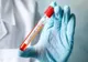 Testele unui bărbat din Hunedoara internat cu coronavirus au ieşit negative. Acesta va fi externat